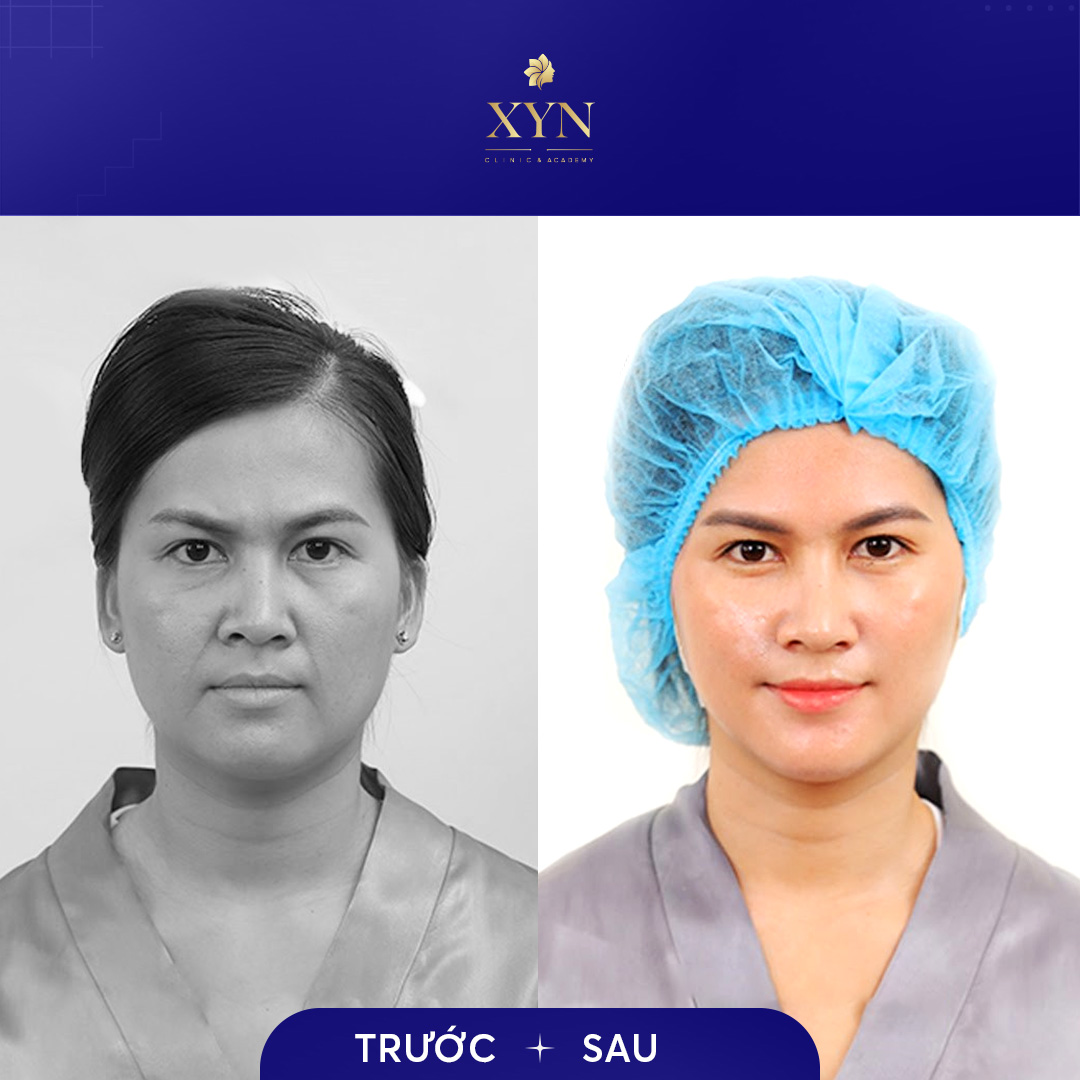 Trang Chủ