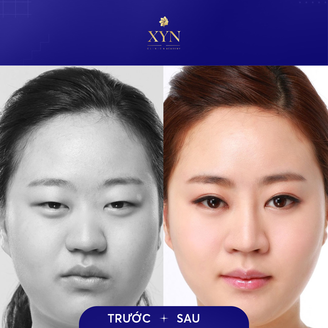 Trang Chủ