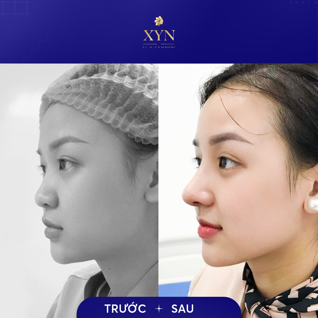 Trang Chủ