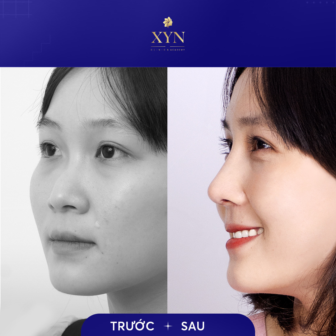 Trang Chủ