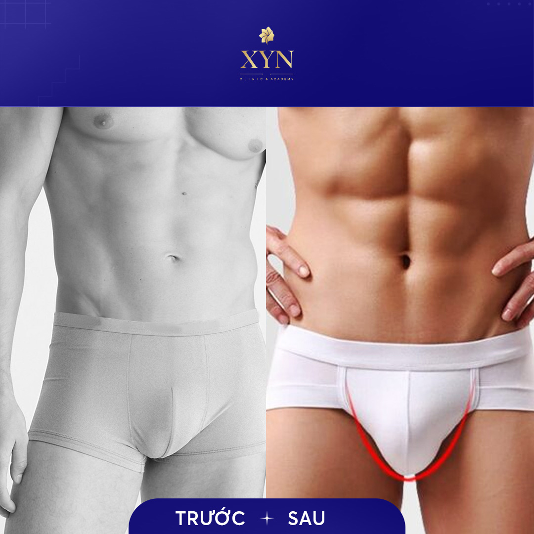 Trang Chủ